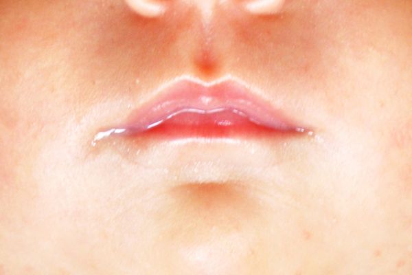 Baby lips